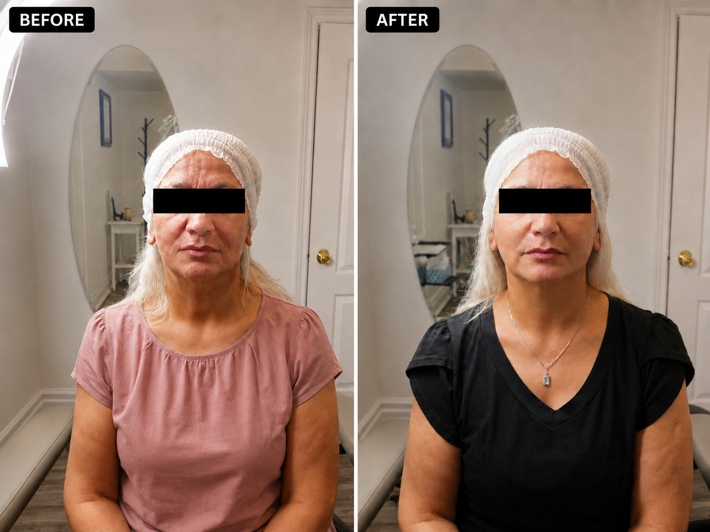 Side-by-side before and after photographs from one individualized treatment plan.